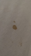 33 weeks and bloody nipple discharge?!