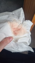 Implantation Bleeding or Chemical Pregnancy?! HELP