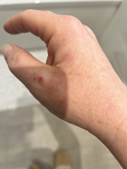 Does this look like an allergy?