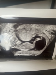 Can anyone guess the gender 💙💕