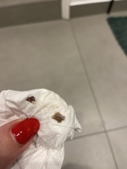 9 weeks pregnant (IVF) - could this be miscarriage? TW blood pics