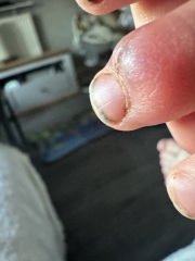 Son hurt finger