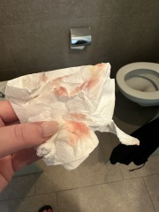 Bleeding at 10 weeks