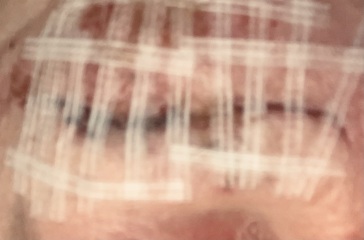 Fell on my Face! Help!