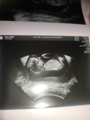 Please could anyone look at my scan for nub theory :)