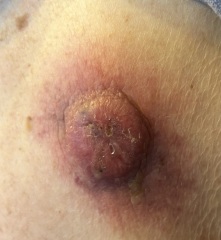 Please help. Just found this on my dad's back.