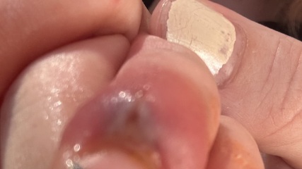 Son hurt finger