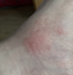 What has eaten me !