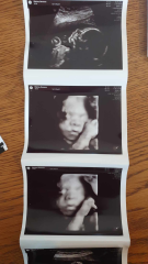 September 2024 - Thread 7! 🐣🧡💛❤️