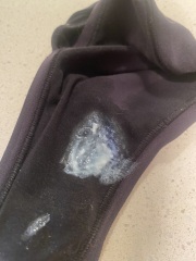 11DPO Symptom Advice (Photos attached TMI)