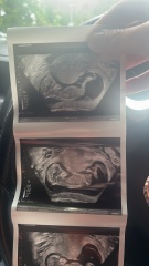 Can you guess my baby’s gender?