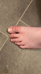 Eczema or any ideas please?