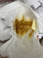 Do these nappies look normal?