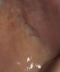 Does my cheek look concerning
