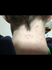 Does this look like shingles?