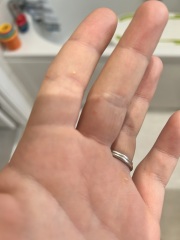 Does this look like an allergy?