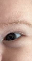 Baby eye colour