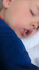 Whats up with my babies face :(