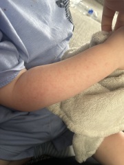 Is this a heat rash ?