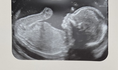 Any gender guesses?? 🩷💙