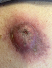 Please help. Just found this on my dad's back.