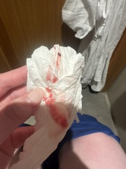 Bleeding at 10 weeks