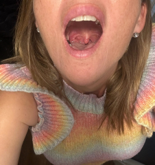 Can anyone tell me if this is a tonsil cyst?