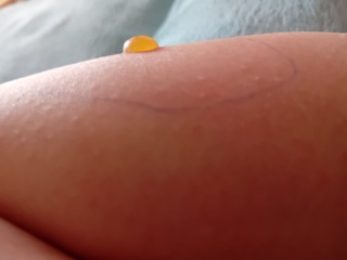 What has bitten me? Warning: pic's included