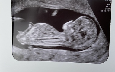 Any gender guesses?? 🩷💙