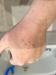 Does this look like an allergy?