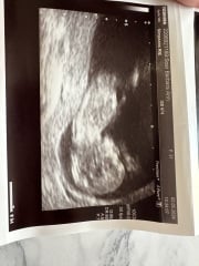 Scan pic gender predictions