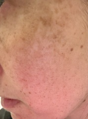 Help - my skin is a mess