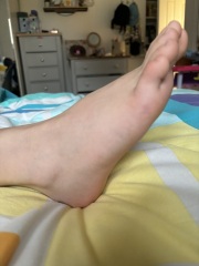 Daughters foot - time for A&E or self care at home?