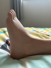 Daughters foot - time for A&E or self care at home?