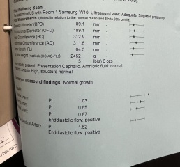 Reduced movement and baby’s weight gain slowed down 36 weeks.