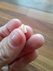 Losing milk teeth at 4