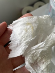 Nearly 9 weeks discharge