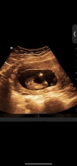 Nub theory 15w 5days x