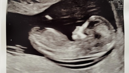 Gender guesses