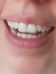 Bad teeth?!