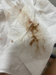 Start of miscarriage pic - help