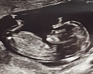 November Babies: Thread 4 (Into the Second Trimester and Beyond!)