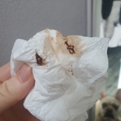 (TMI) spotting/bleeding at 6-7dpo?