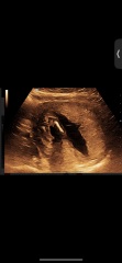 Nub theory 15w 5days x