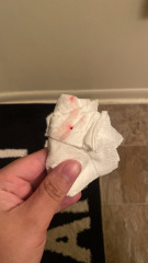 implantation bleeding?