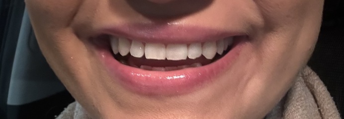 What type of cosmetic surgery is this?