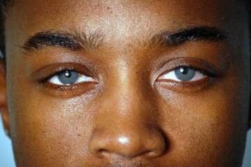Can someone explain chances of 4 kids with blue eyes when one parent is brown eyed?