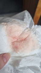 Implantation Bleeding or Chemical Pregnancy?! HELP