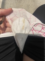 Pregnancy Discharge