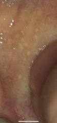 Does my cheek look concerning